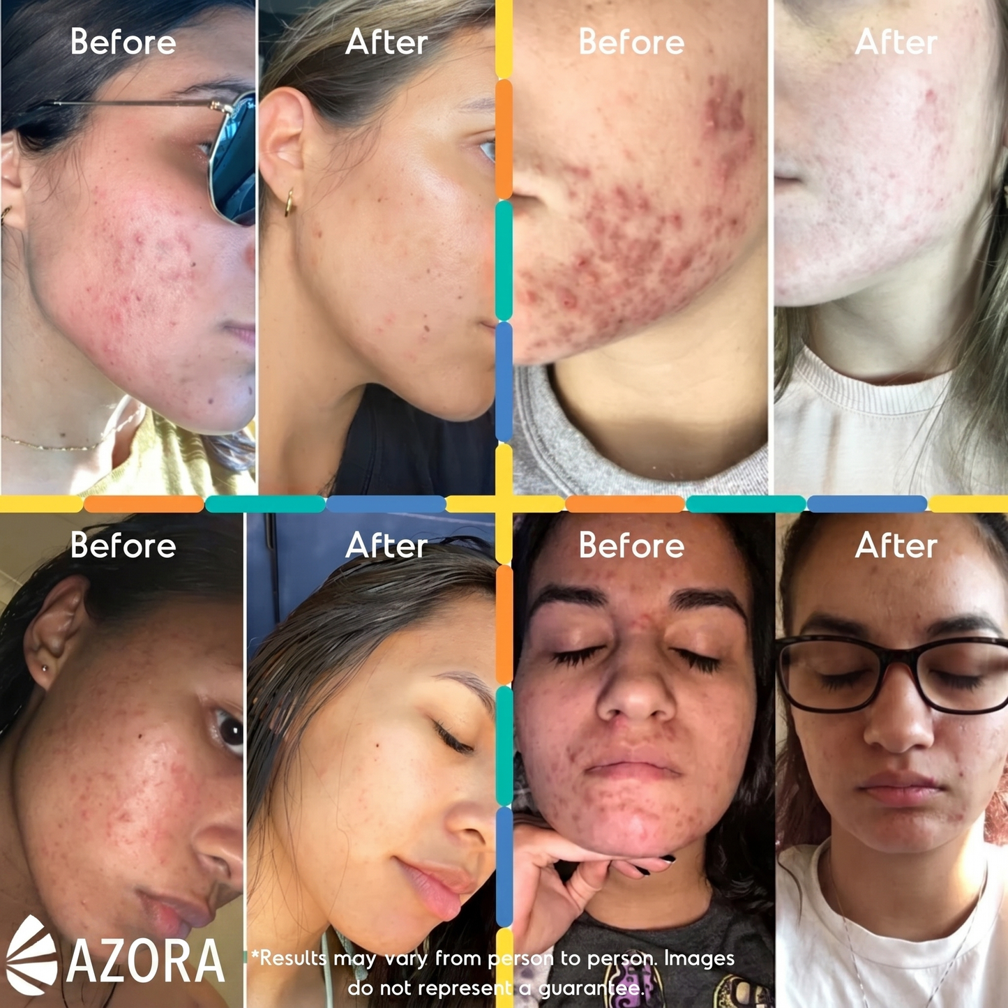 Mandelic Acid Serum