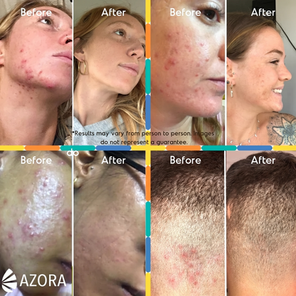 Azora Mandelic Acid Serum